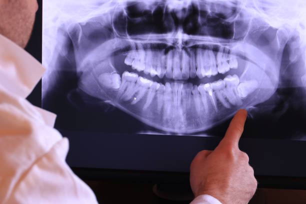 Best Broken Tooth Emergency  in East Speer, NC